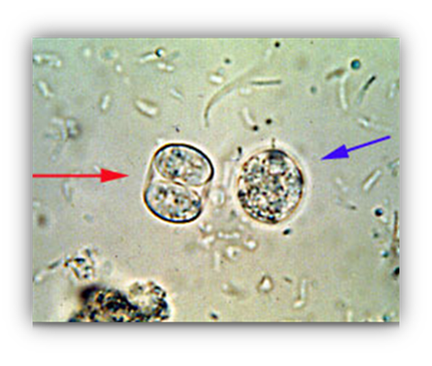 <p>Toxoplasma gondii</p>