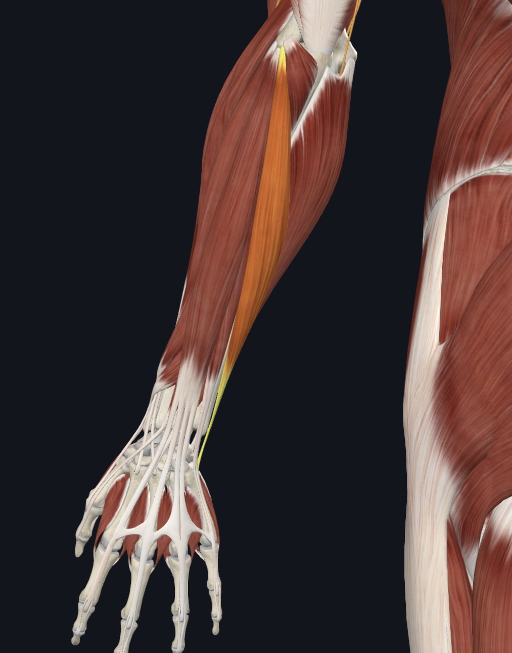 term image