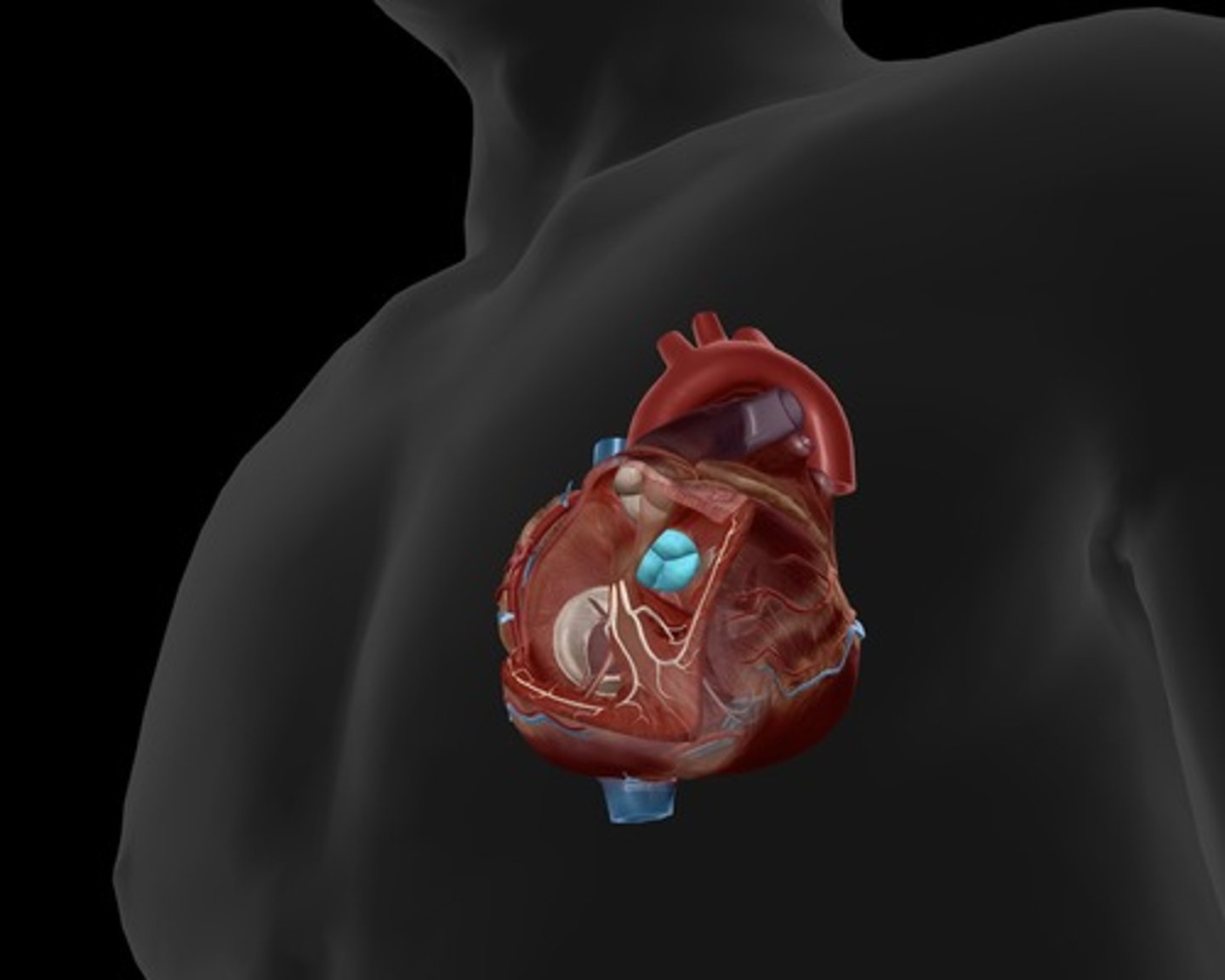 <p>located between the left ventricle and the aorta</p>