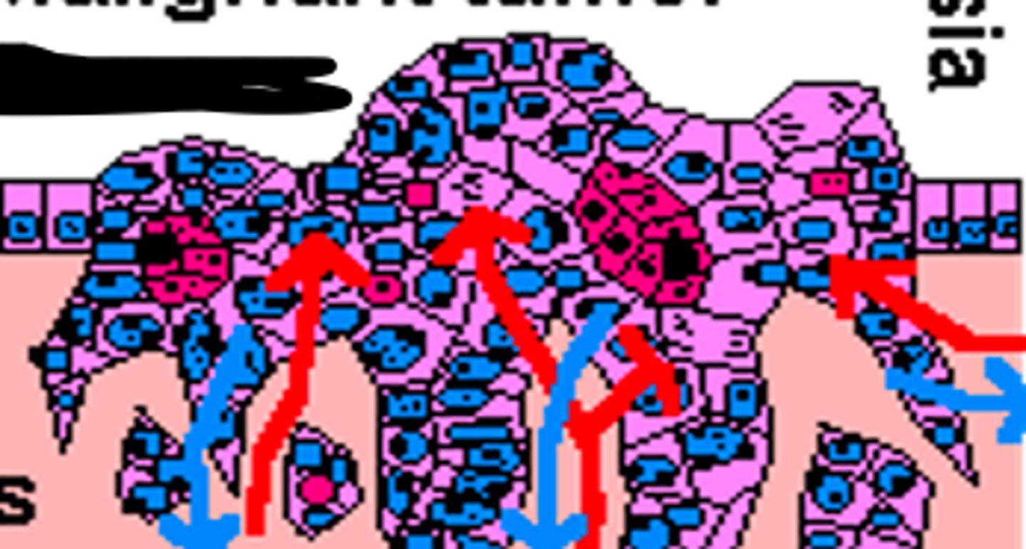 <p>malignant tumor - cancer</p>