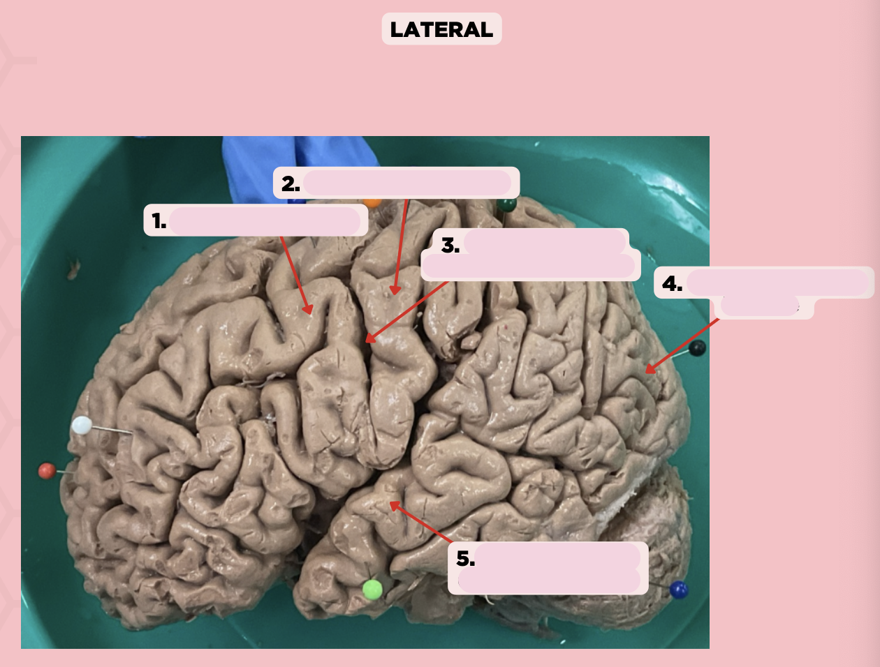 <p>Identify the structure labeled as 2.</p>