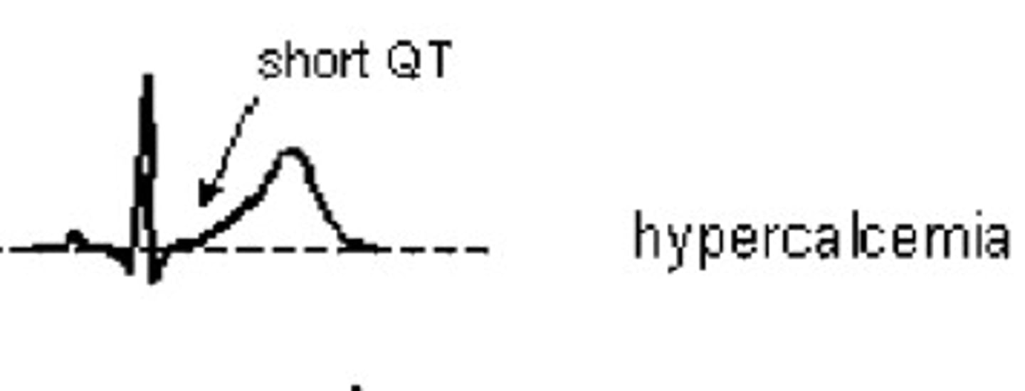 <p>Short/absent QT segment</p><p>(tooo healthy --&gt; short QT (skinny))</p>