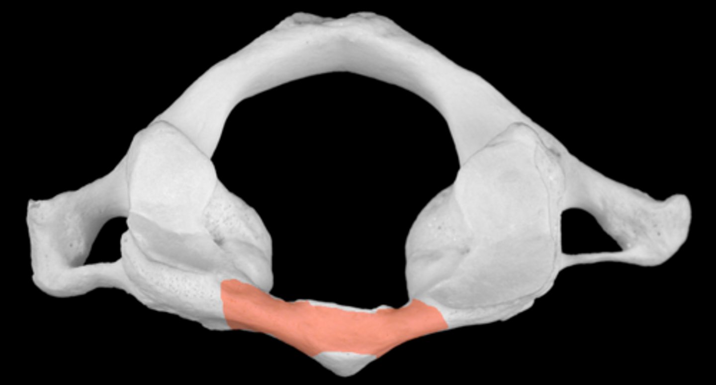 <p>articulates with dens of C2</p><p>'no movement'</p>