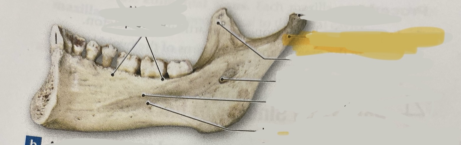 <p>what structure is this?</p>