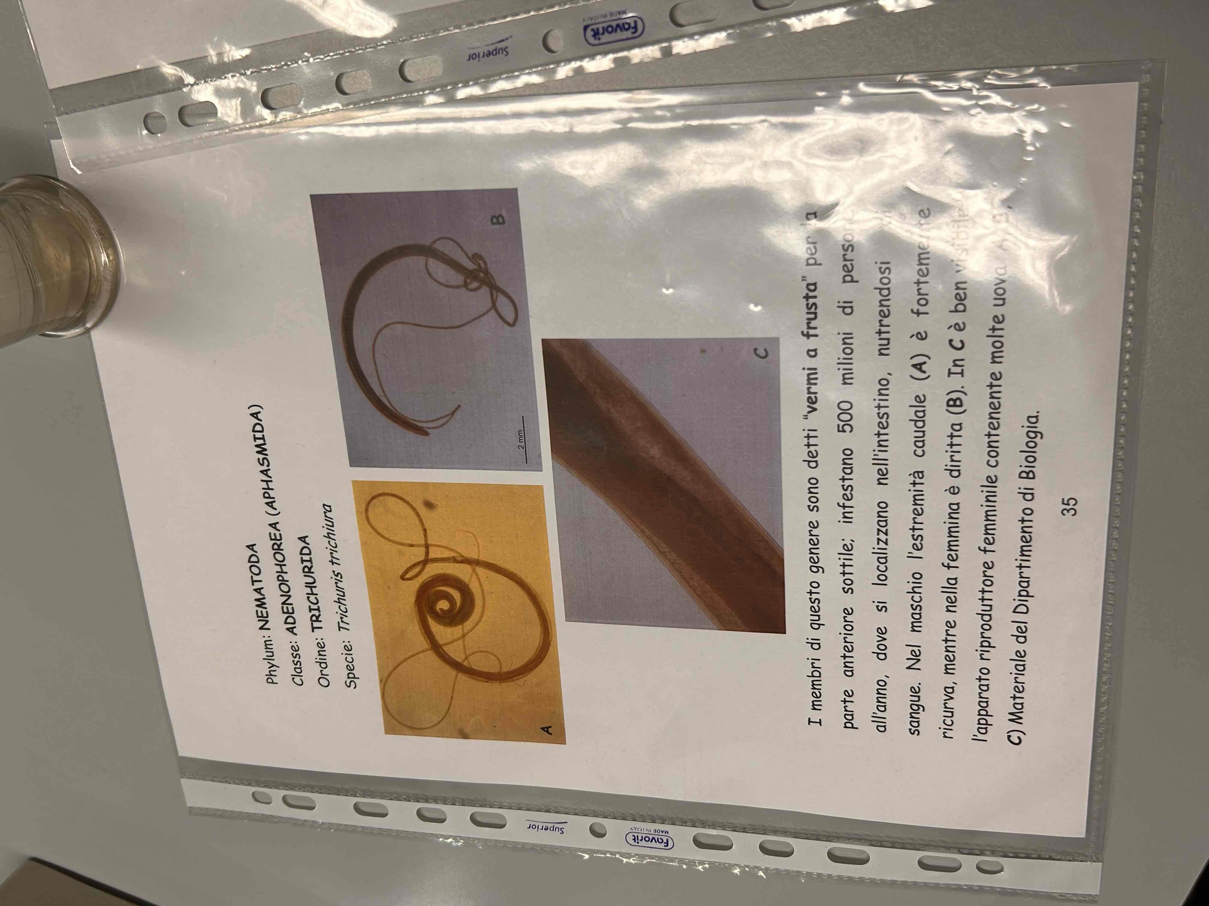 <p>Trichuris trichiura</p>