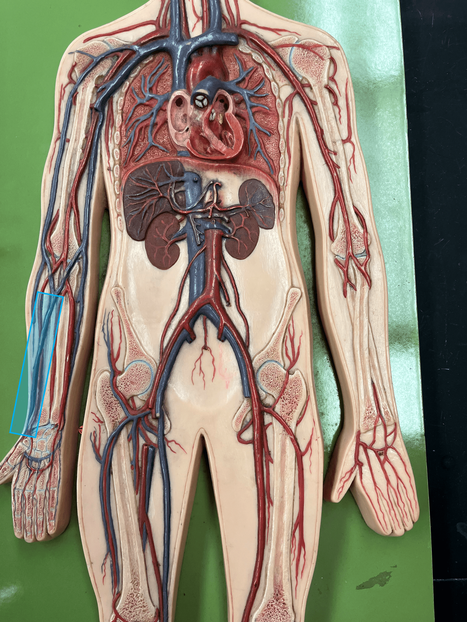 <p>• A vein of the upper limb.</p>
<p>• Drains the lateral hand and forearm.</p>
<p>• Empties into the brachial vein.</p>