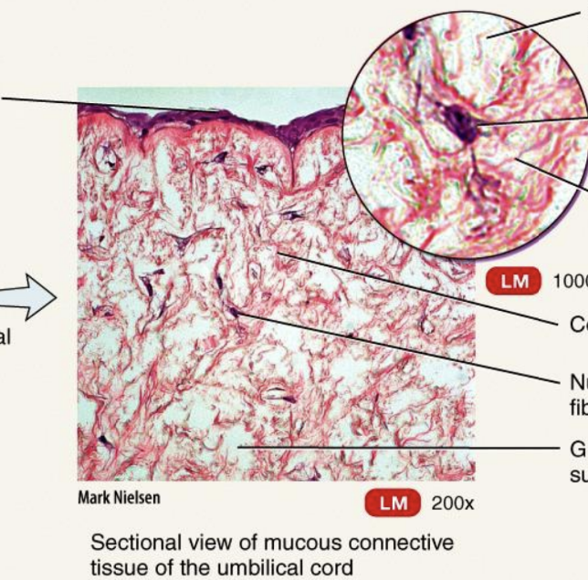 <p>Embryonic Connective Tissue: Mucous Connective Tissue</p>