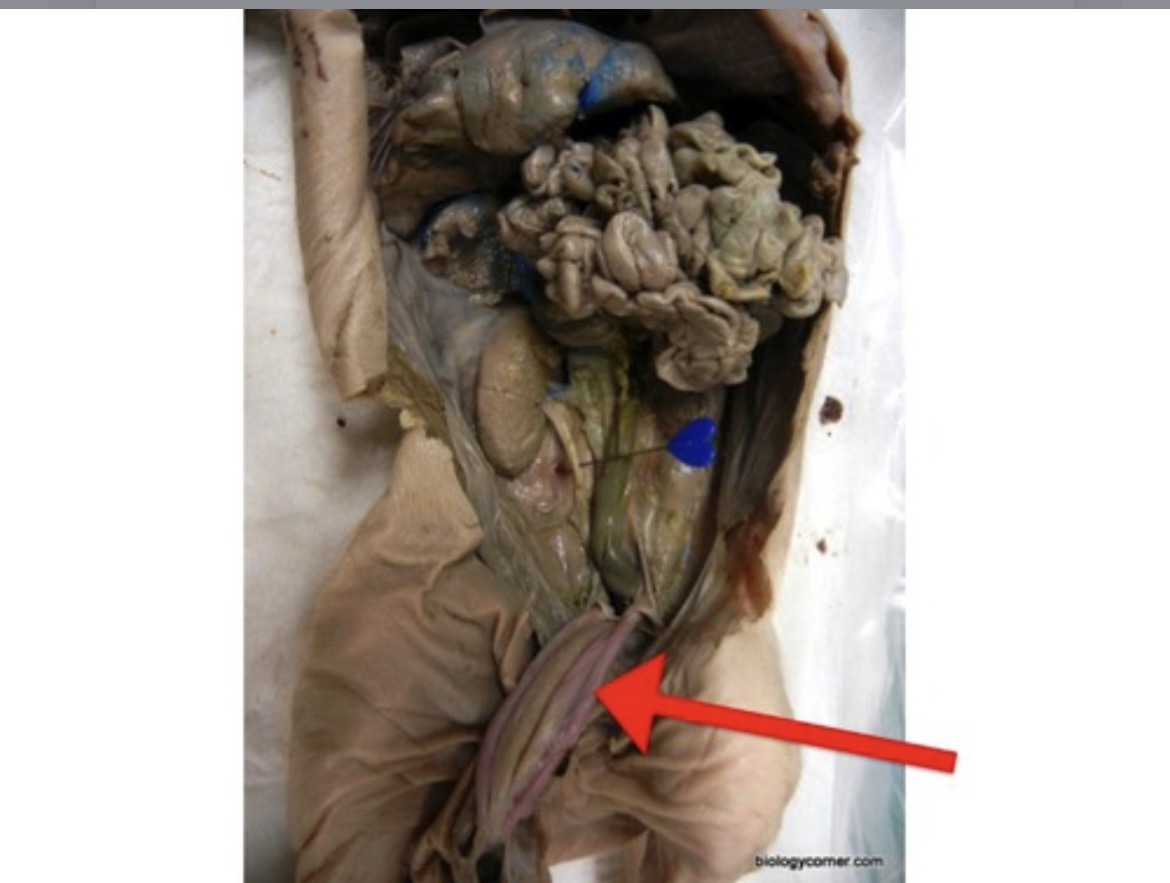 <p>Fetal vessel carrying deoxygenated blood and wastes from fetus to placenta.</p>