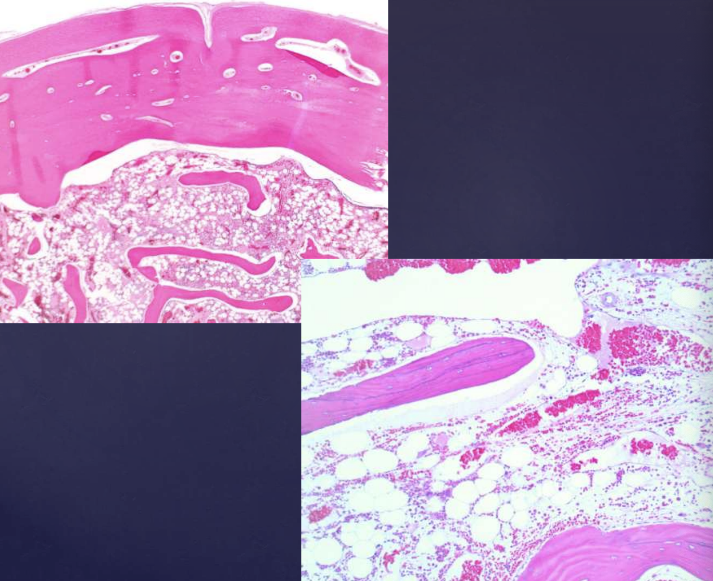 <p>what are histopahtologic features of osteomas?</p>