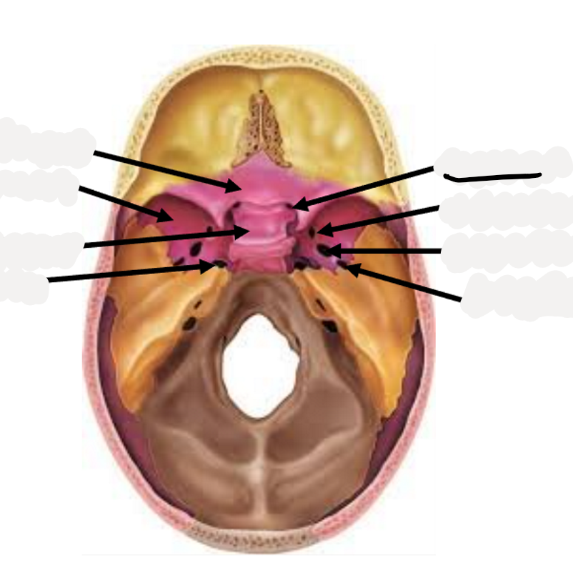 <p>Optic nerve (CN II)</p>