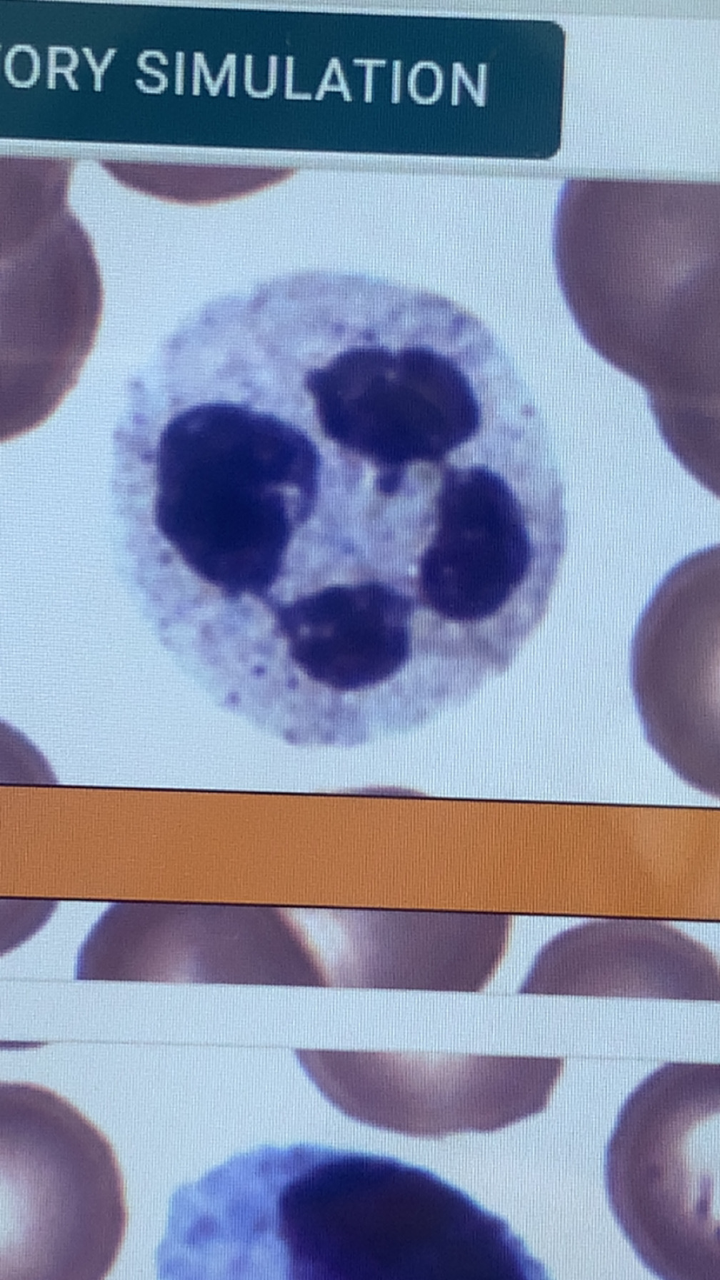 <p>Neutrophil</p>