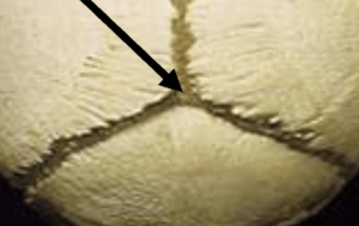 <p>anterior fontanel</p>