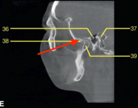 <p>identify the structure </p>