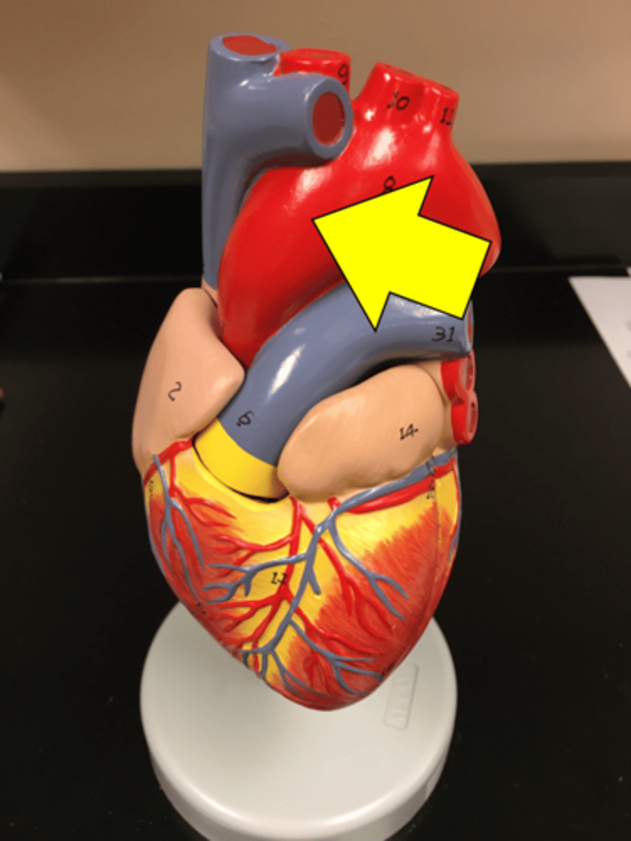 <p>Name the red vessel.</p>