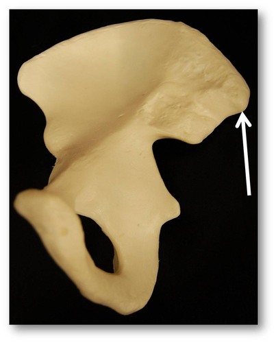 Name this specific part of the pelvic bone.