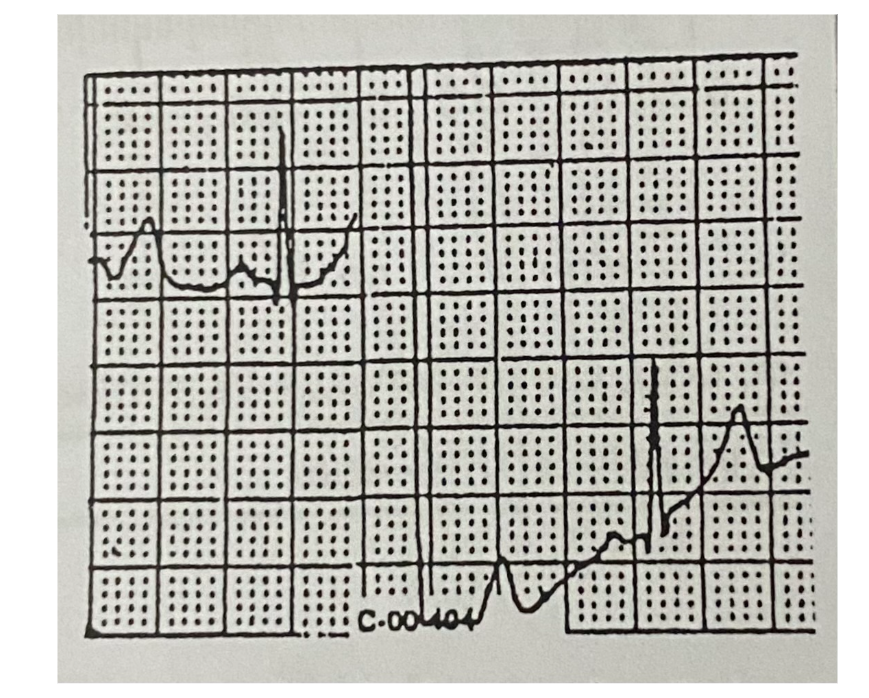 <p>What does this mean?</p><p></p>