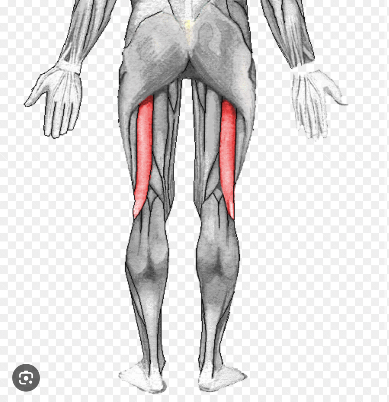 <p>The femur the long bone in the thigh</p>