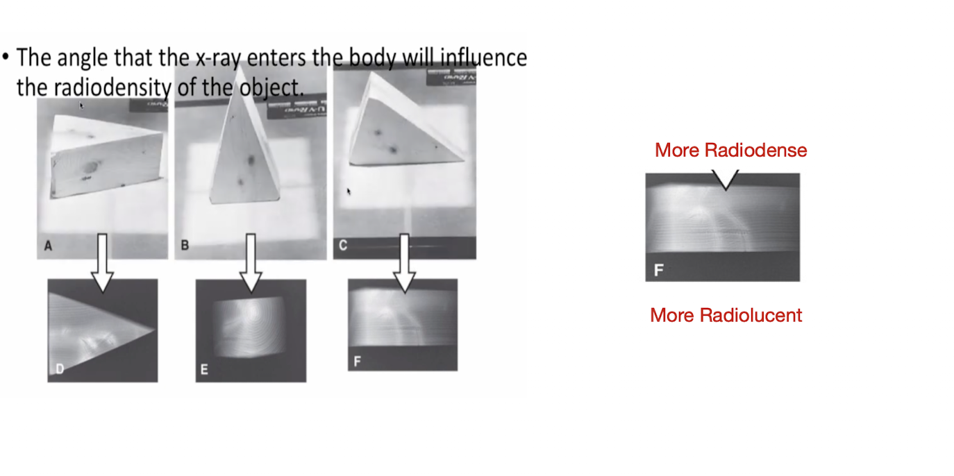 <p>Angle of Projection:</p><ul><li><p>The angle that the X-Ray enters the body will influence what? </p></li></ul><p></p>