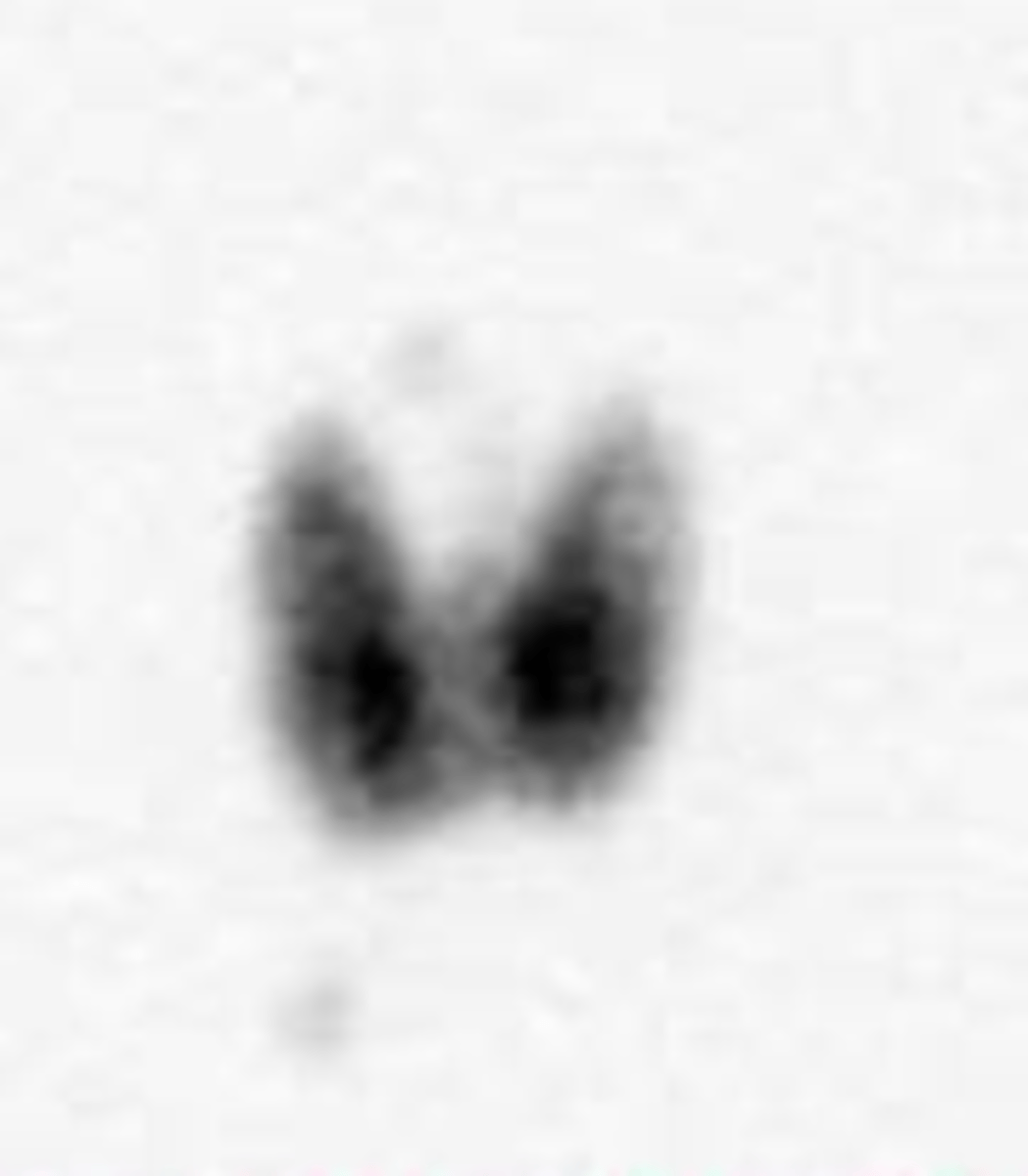 <p>What image view is this?</p>