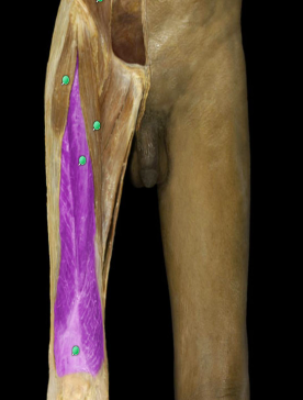 Extension of leg
Flexion of thigh at hip joint (rectus femoris only)