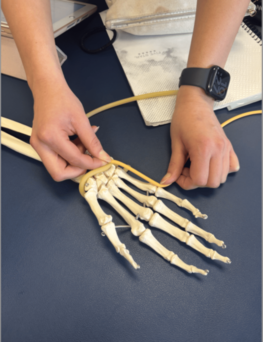 <p>What is this muscle?</p>