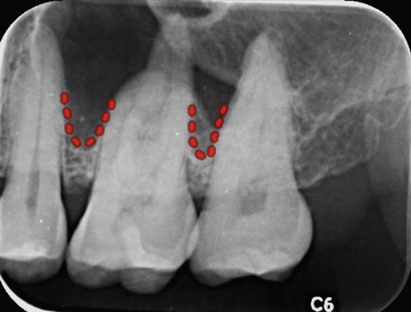 <p>What are the red dotted lines representing?</p>
