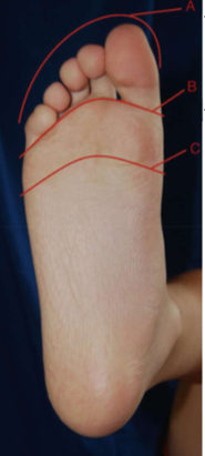 <p>What is the name of the toe plate trimline C? When is it used?</p>