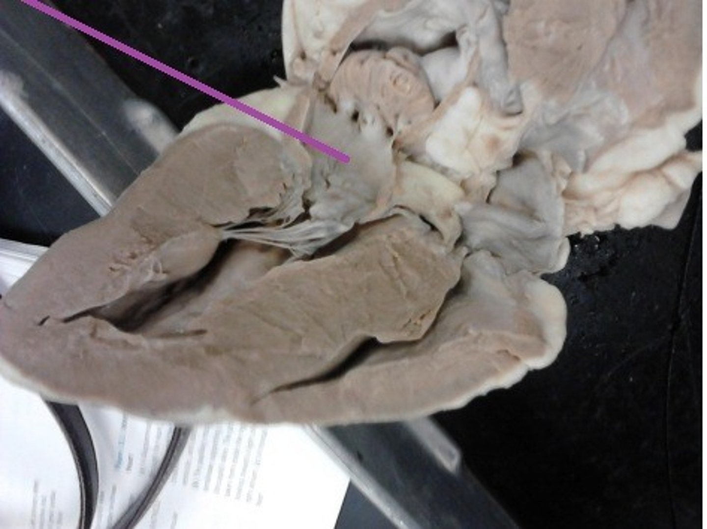 <p>Identify the chamber.</p>