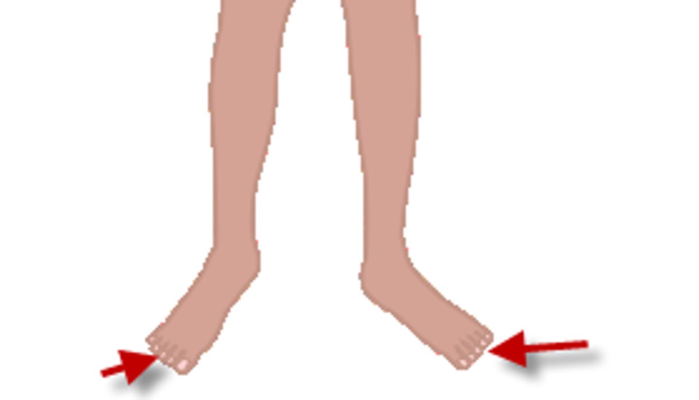 <p>toe</p>