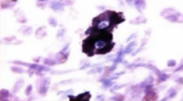 <p>Identify this cell stained with <strong>toluidine blue</strong></p><ul><li><p>note the <strong>pale stained nucleus </strong></p></li><li><p>note the cytoplasm filled with <strong>basophilic glanules</strong> </p></li></ul><p></p>