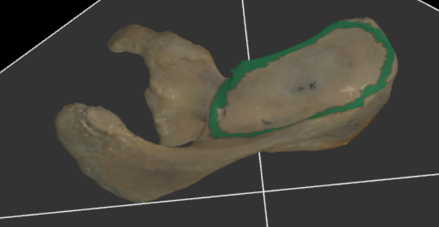 <p><span>gans het gebied boven de spina scapulae op de facies posterior</span></p>