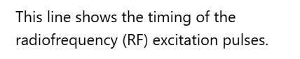 <p>A. Radiofrequency (RF)</p>