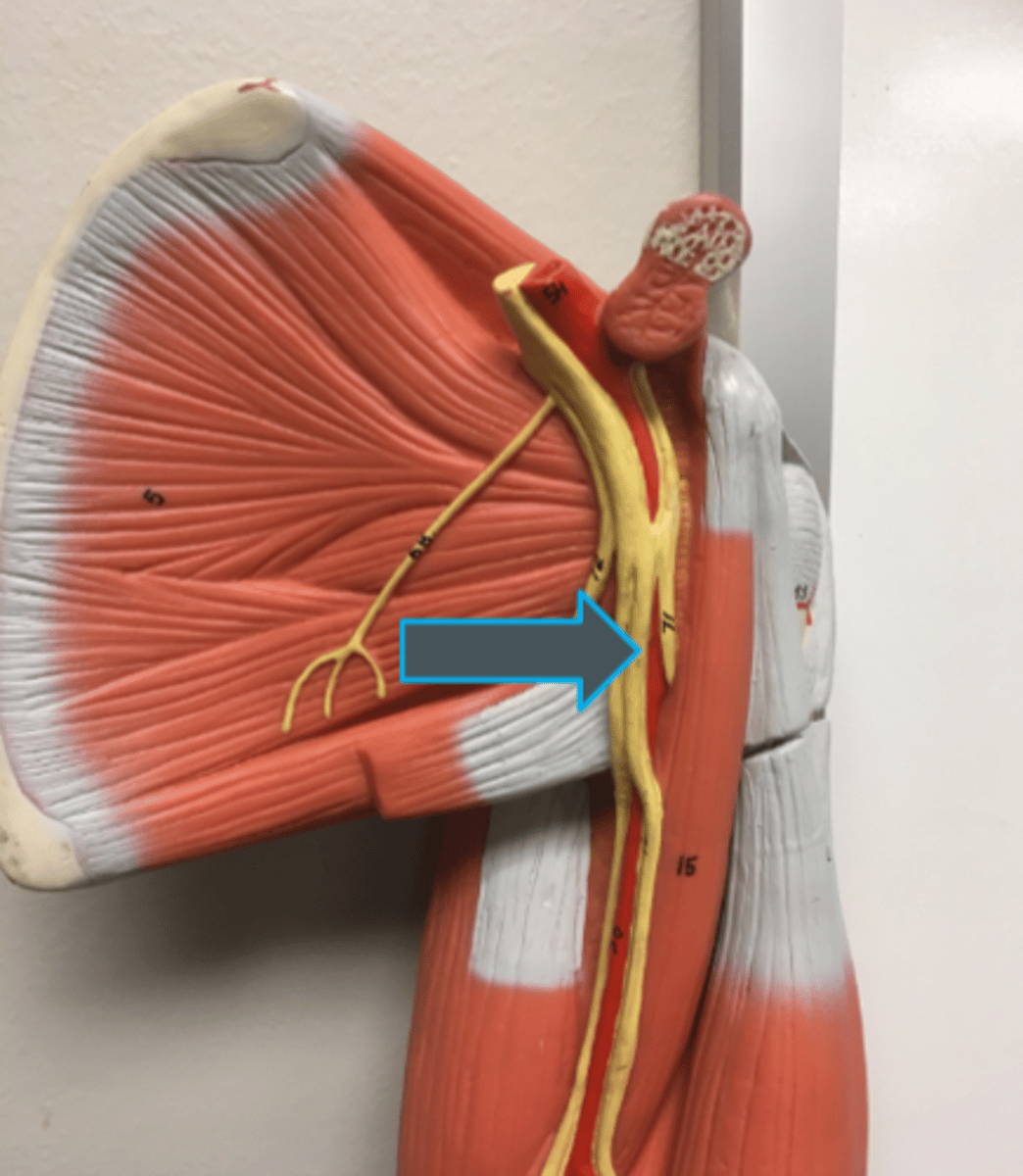 <p>innervates:<br>-pronator teres<br>-forearm flexors</p>