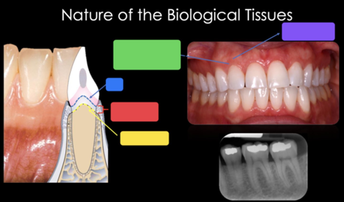 <p>Identify the structure in the red box</p>