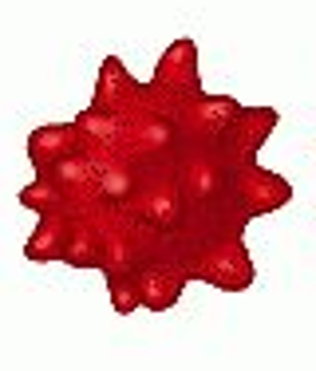 <p>Condition that results in animal cells that are placed in a hypertonic solution in response to water leaving the cell causing the cell to shrivel</p>