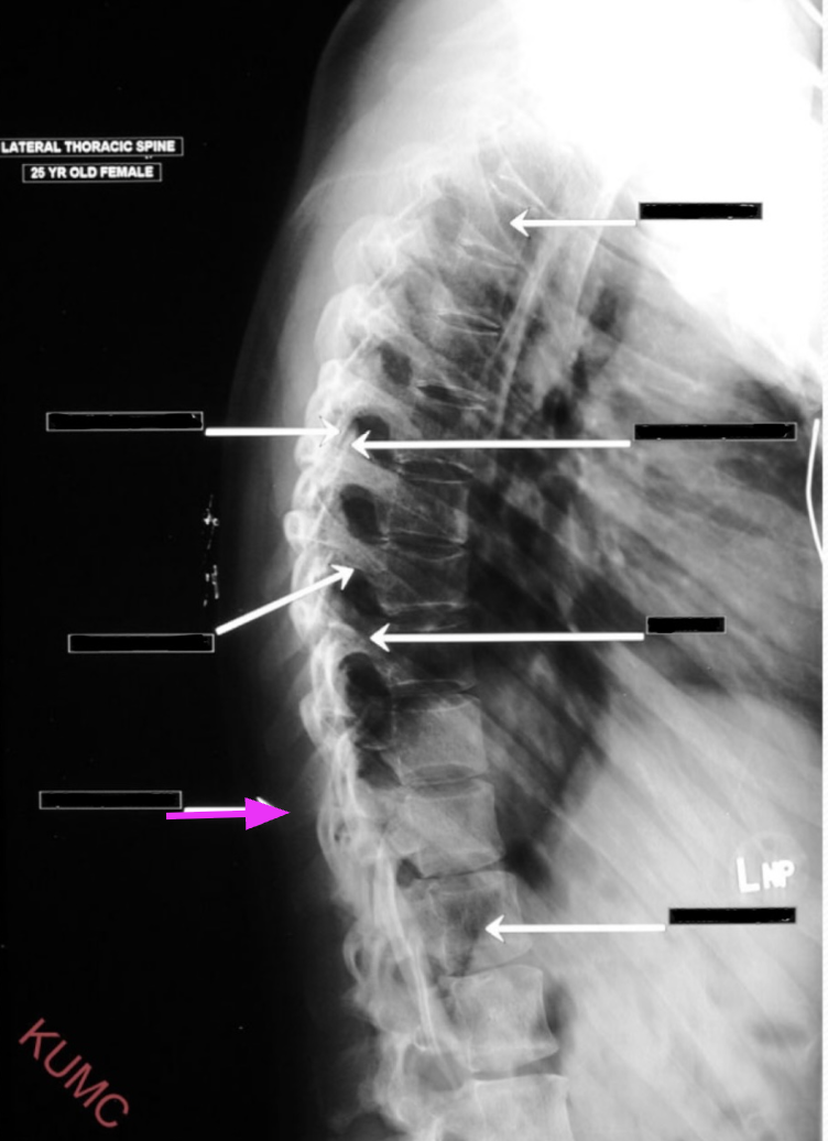 <p>What structure is referenced by the arrow highlighted in pink?</p>