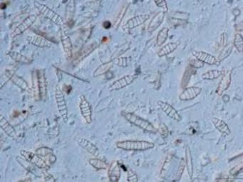 <p>What are diatoms and their ecological role? </p>