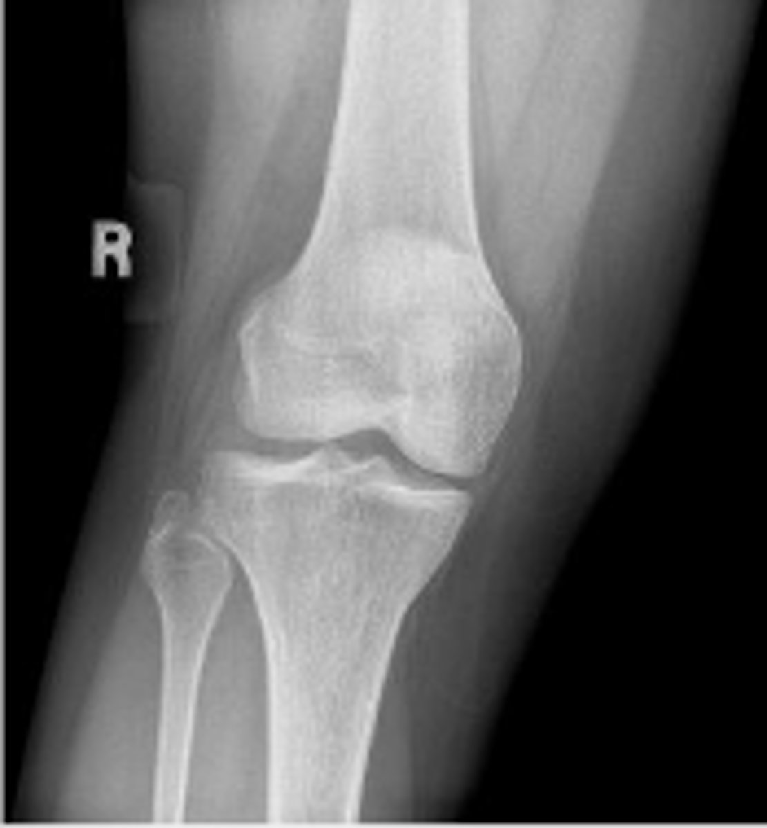 <p>What is the name of the radiographic view?</p>