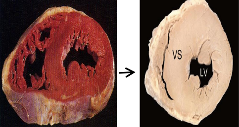 <p>? </p><p>reversible or irreversible ? </p>