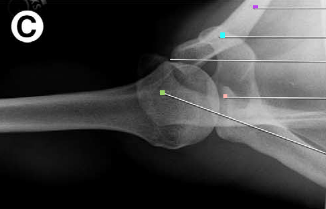 <p>What structure is the green square indicating? (not humerus)</p>