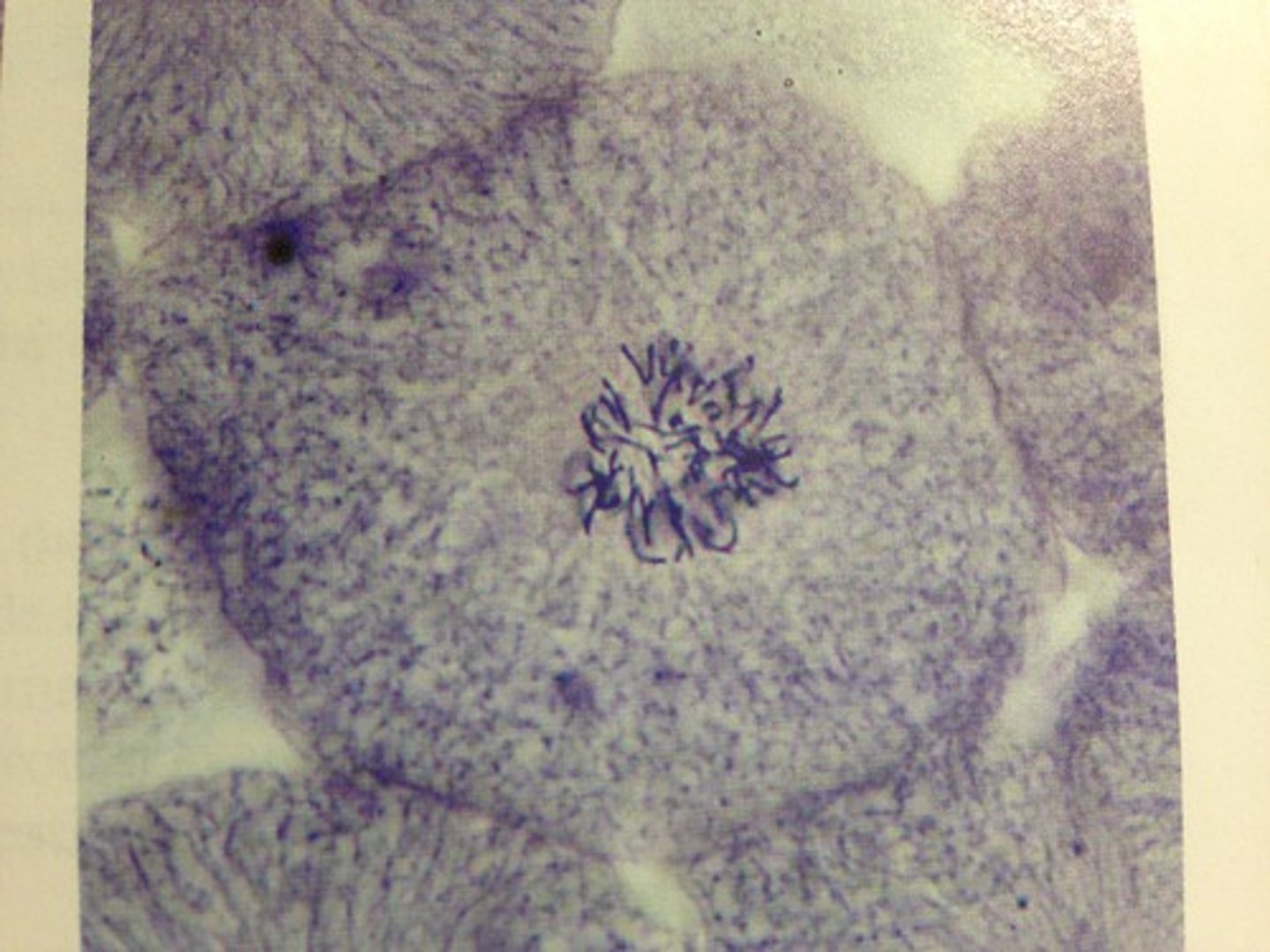 <p>nuclear membrane has broken down and more condensed than in early prophase. Microtubules attach to chromosomes and the mitotic apparatus takes shape but not completely spindle shaped.</p>