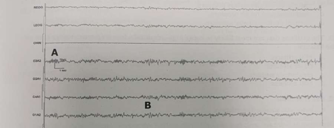 <p>What waveform is seen at the b mark </p>