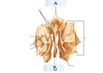 <p>What is B? (landmark)</p>