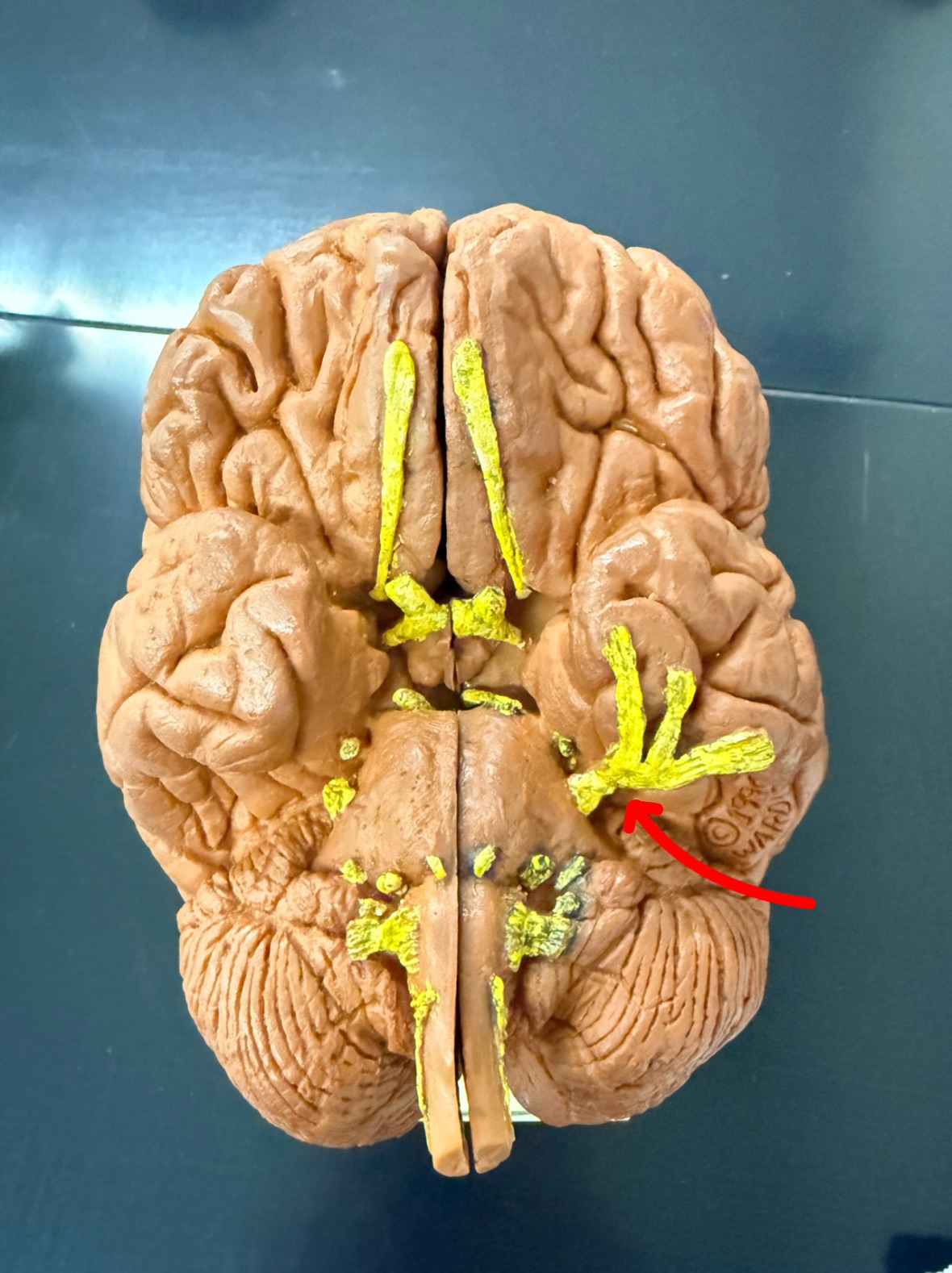 <p>Name the cranial nerve on the brain model</p>