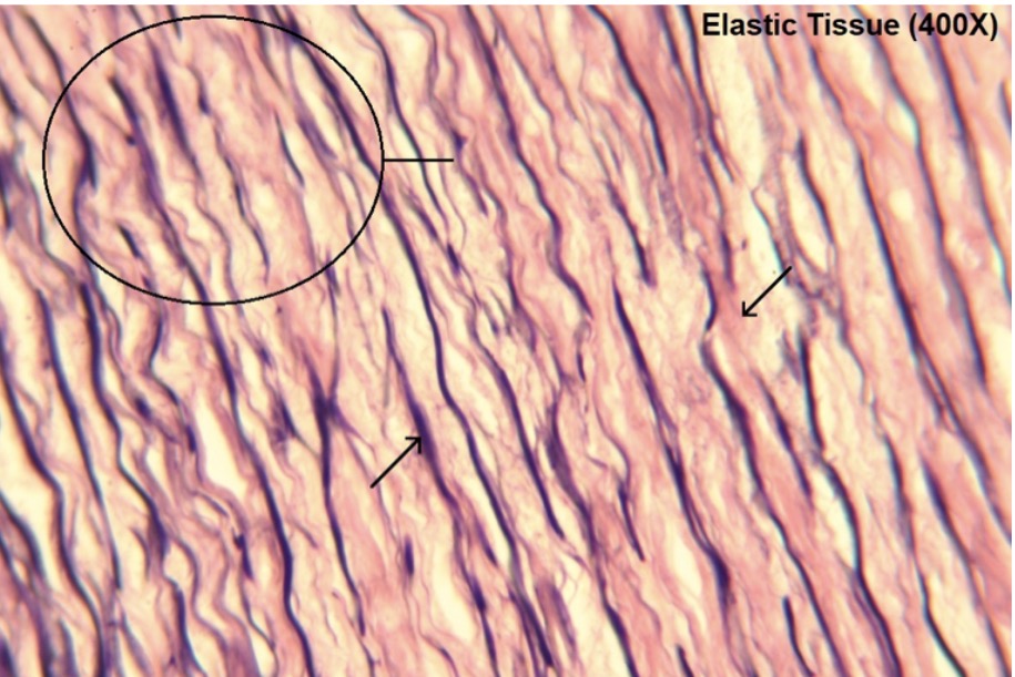 <p>what type?</p>
