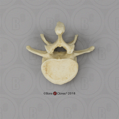 <p>Identify the part of the vertebra and explain what diagnostic features helped you reach your conclusion.</p>
