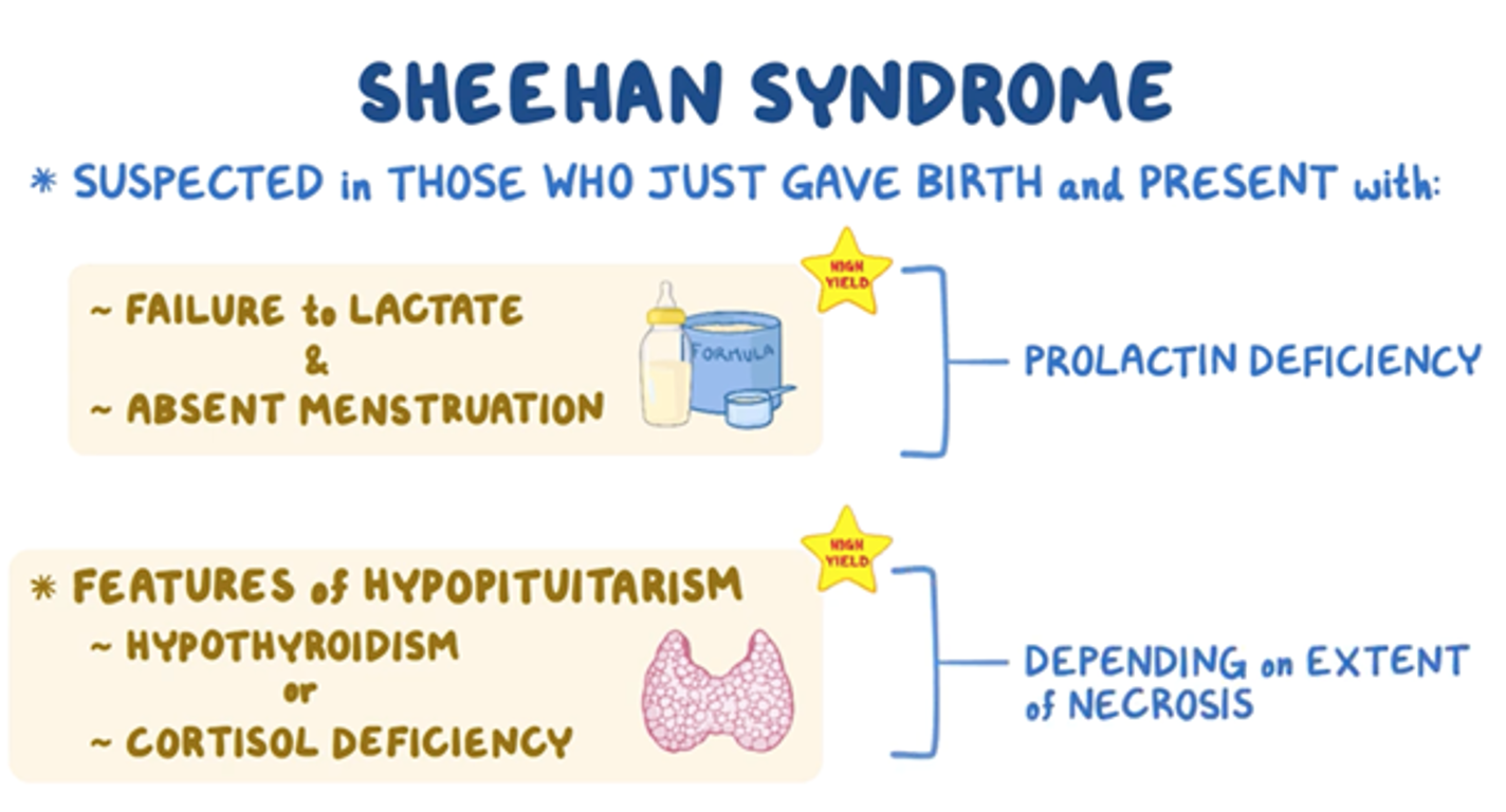 <p>Sheehan Syndrome</p>