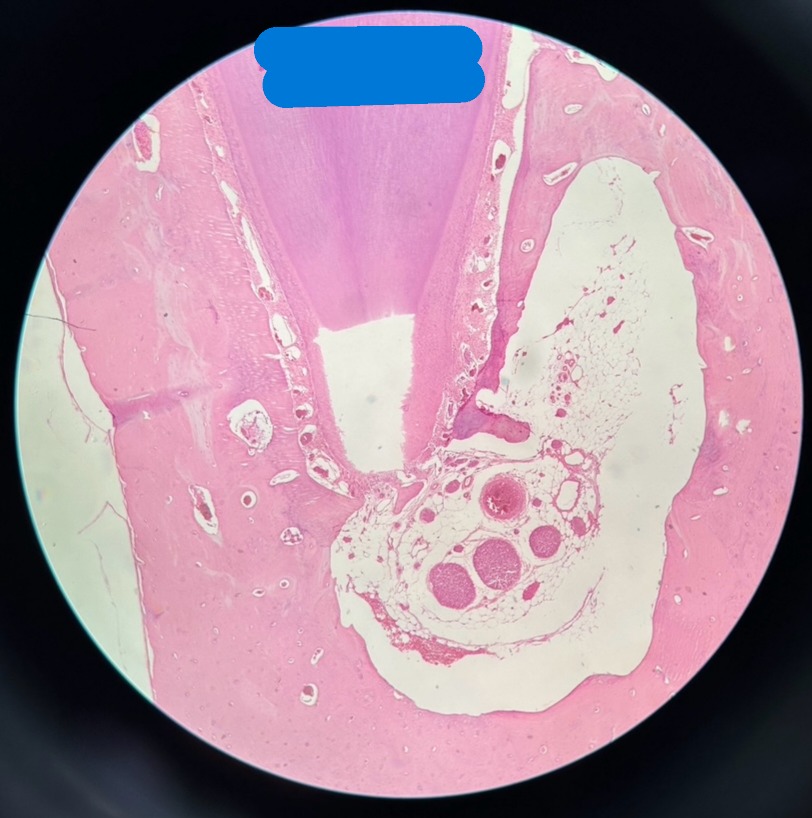 <p>Organ?</p>