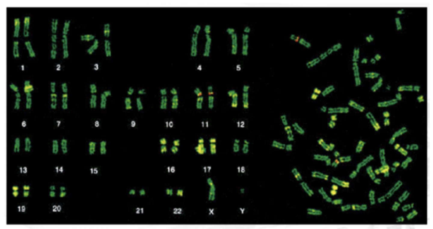 <p>We use UV light to visualize it</p><p>&gt; Shorter wavelength</p><p>&gt; Higher frequency and energy</p><p>Light staining areas are green</p><p>&gt; G and C-rich regions</p><p>Dark staining areas are the apple green ones or the yellow-green</p><p>&gt; Contains adenine and thymine-rich regions</p>