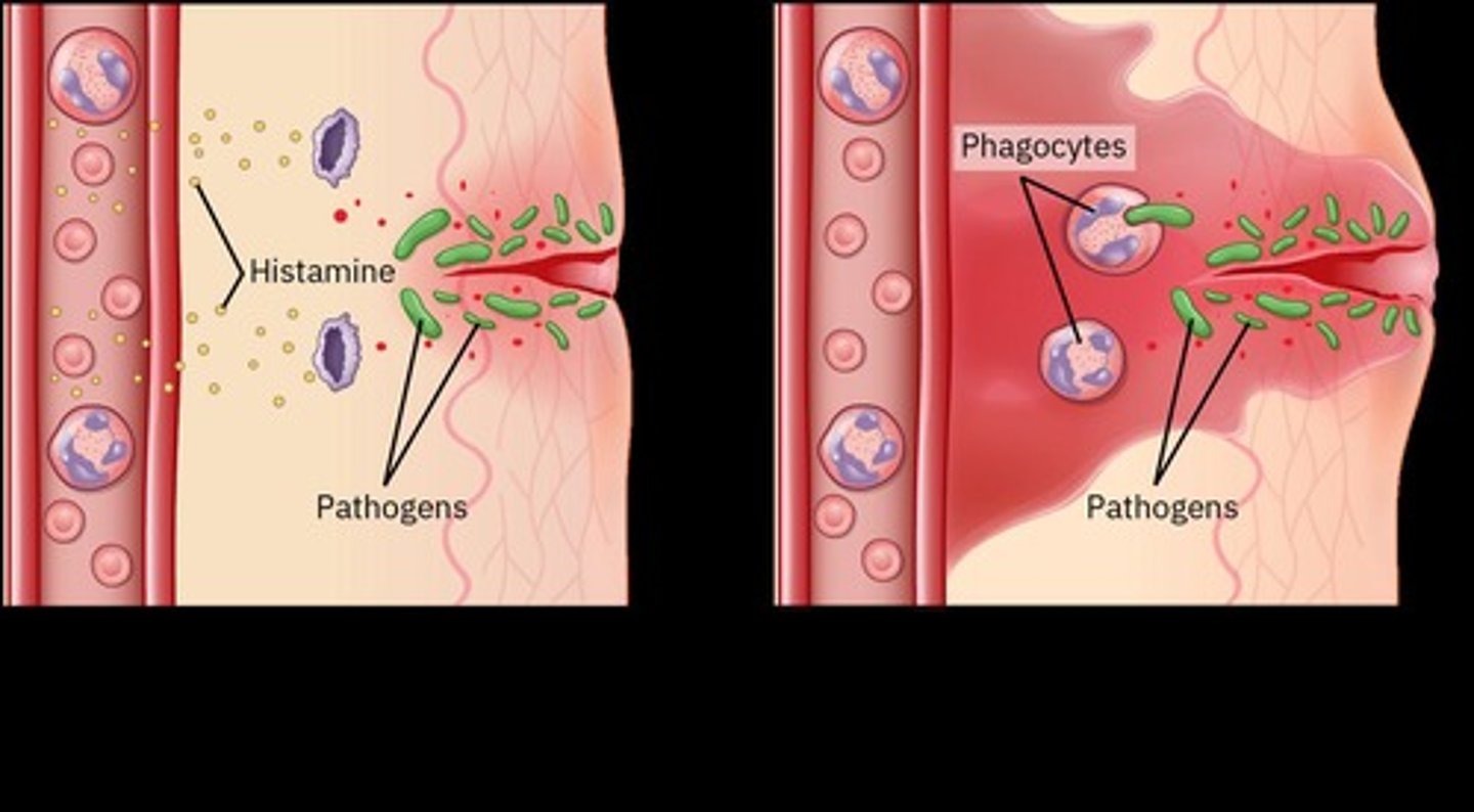 <p>Redness, swelling, heat, pain, and loss of function.</p>